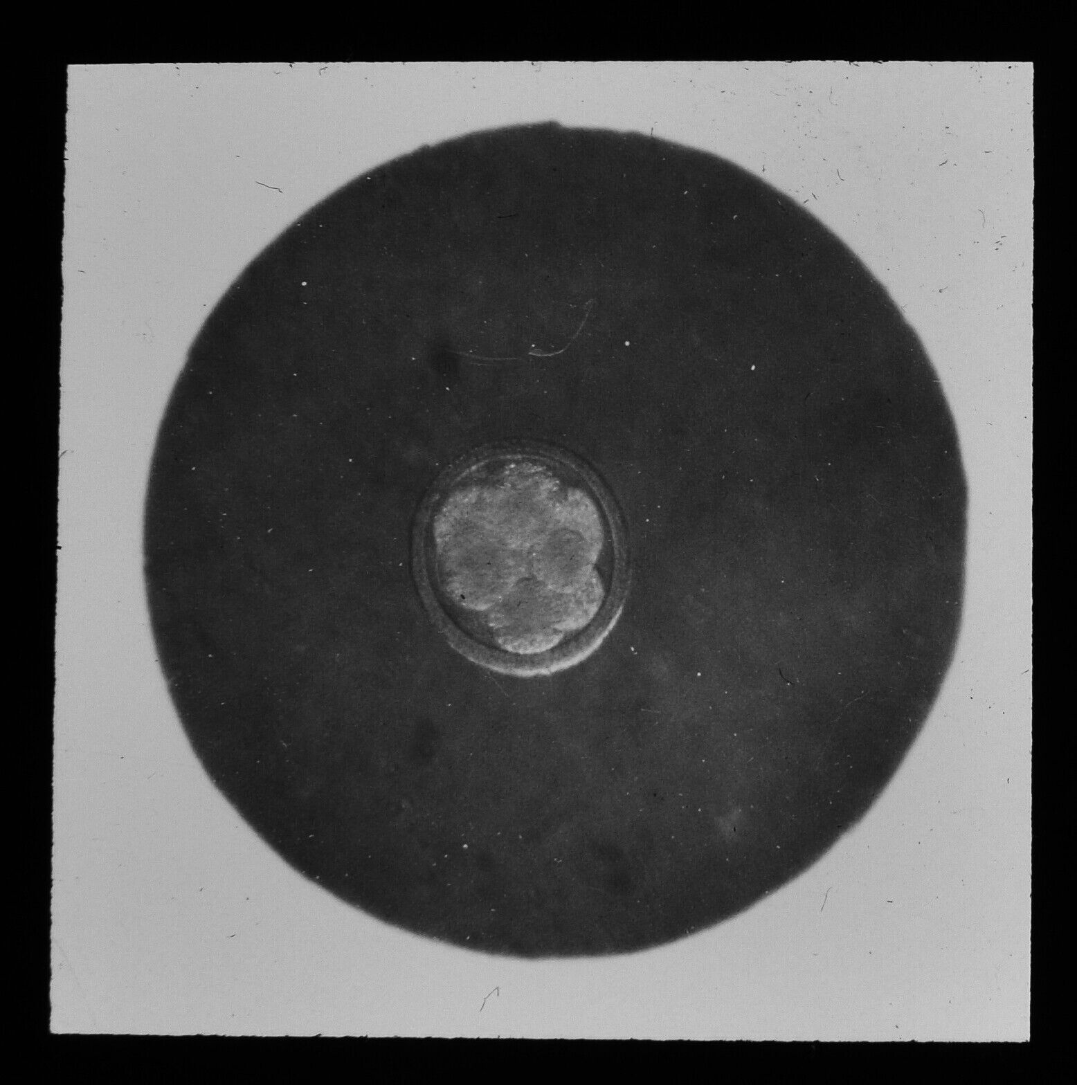 VINTAGE Magic Lantern Slide CELLS NO5 C1950 MEDICAL PHOTO HUMAN ? CYTOLOGY 