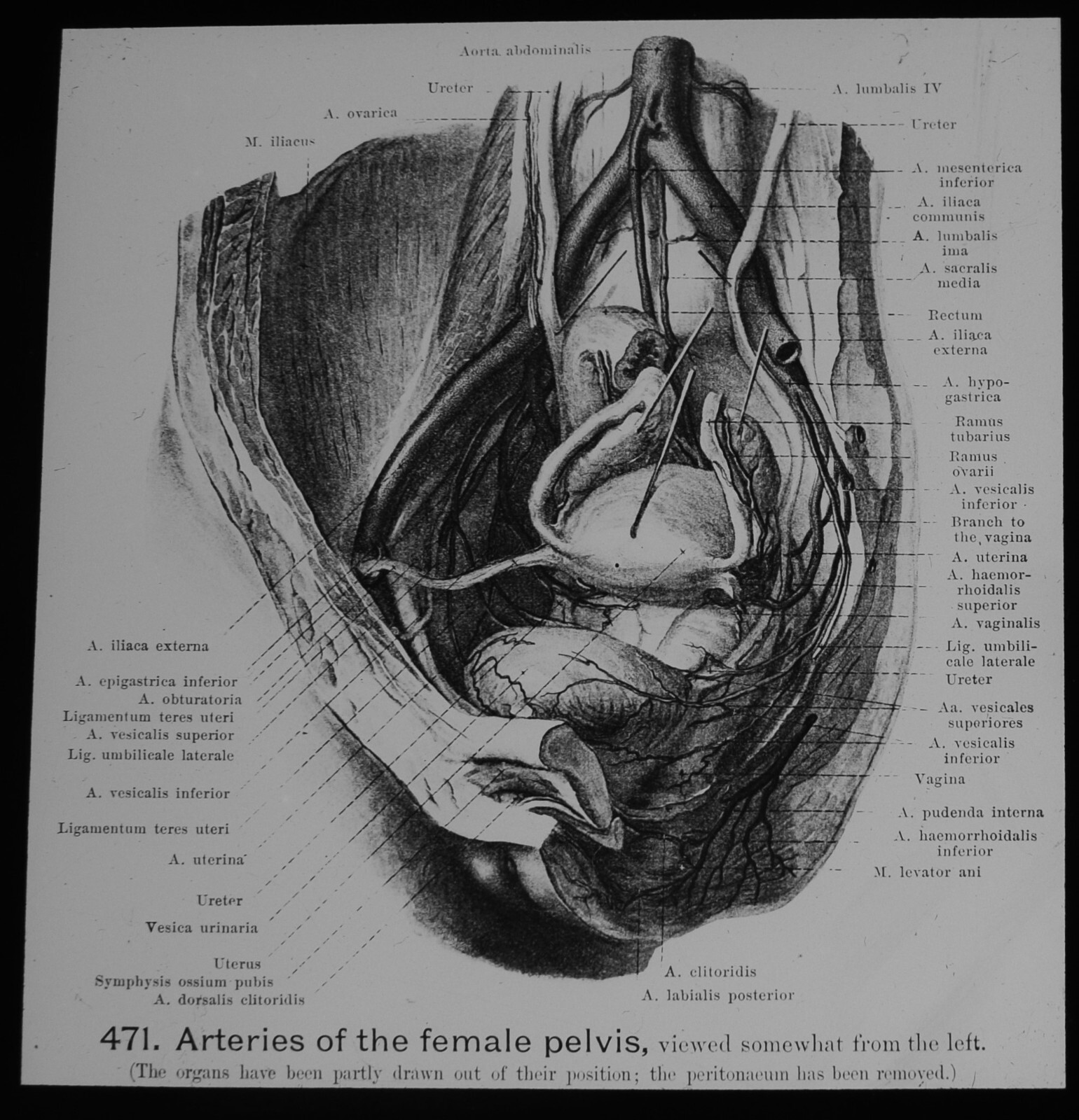 HUMAN FEMALE PELVIS ARTERIES C1950 Magic Lantern Slide VINTAGE MEDICAL DIAGRAM