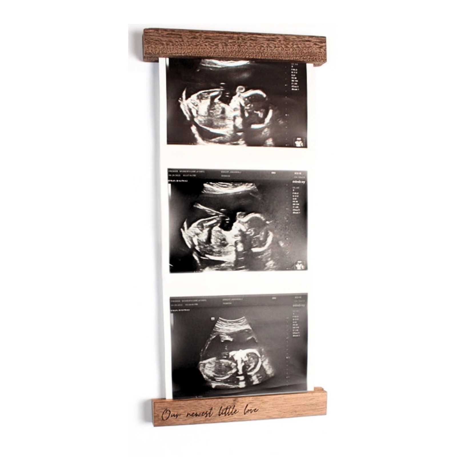 Sonogram picture frame | Ultrasound Keepsake for Baby | Ideal Pregnancy Annou...