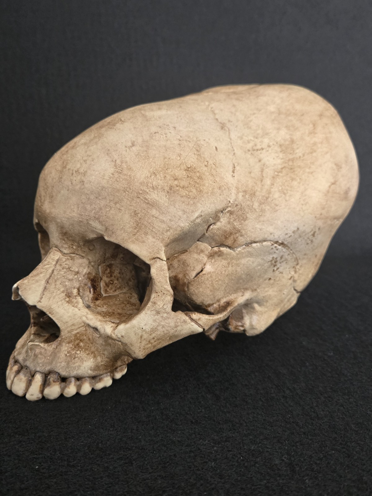  Human Skull Enlongated Realistic 