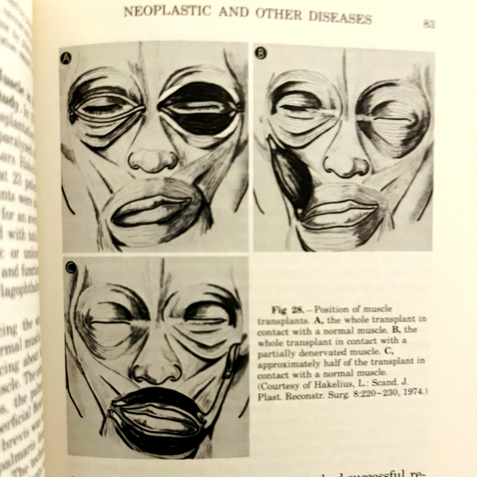 Vintage Yearbook of Plastic Reconstructive Surgery Lot of 8 Books Hardcover 1975