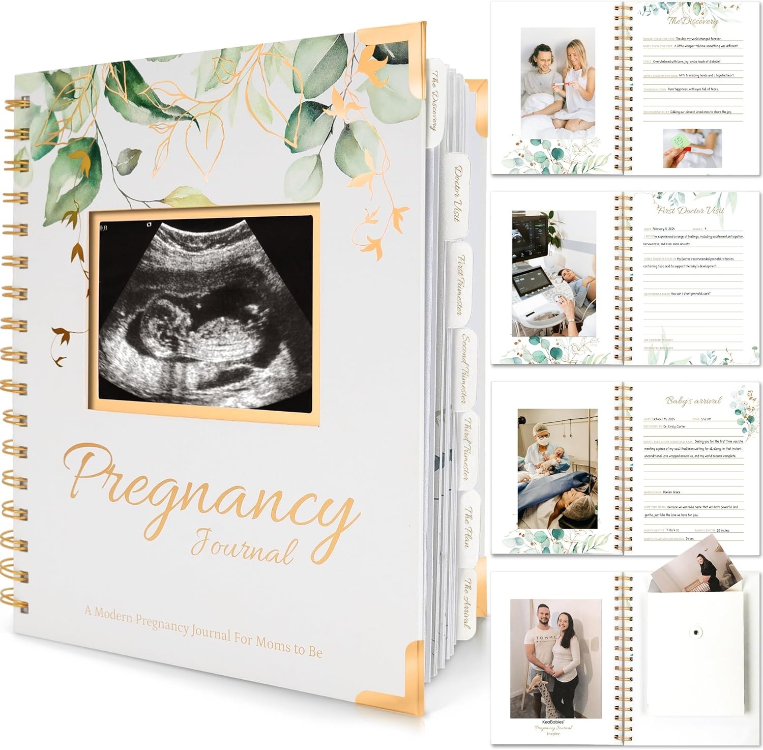 Pregnancy Journal for First Time Moms Gifts - 90 Pages Hardcover Pregnancy Memor