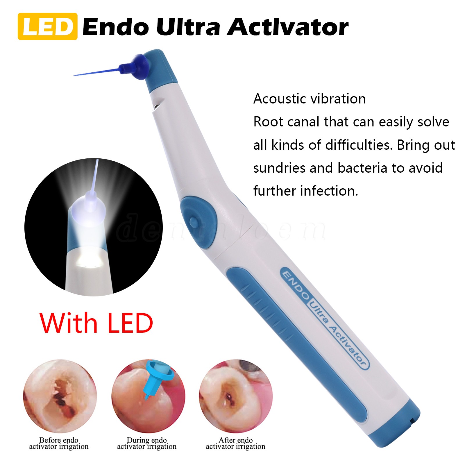 Dental Endo Ultra Activator Ultrasonic Irrigator Root Canal Sacling Handpiece