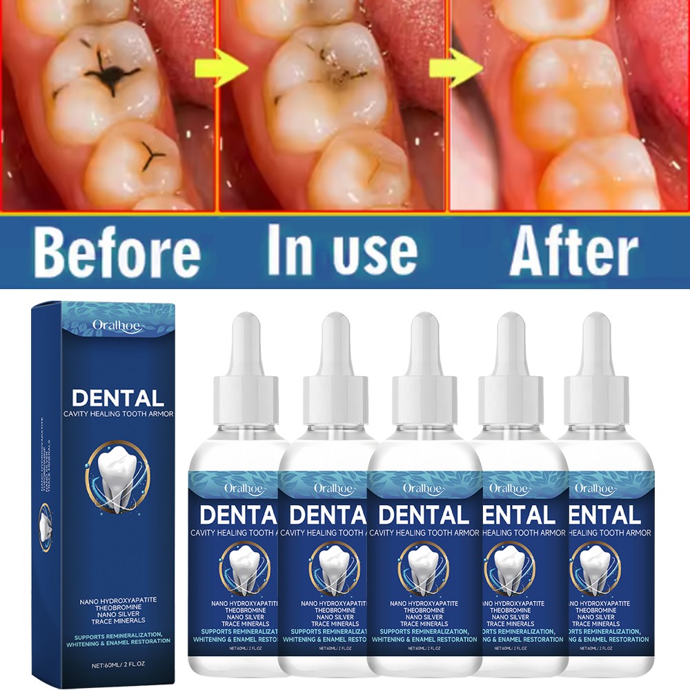 Dental Cavity Healing Tooth Armor Damaged Gums Tooth Care Solution Repair Serum