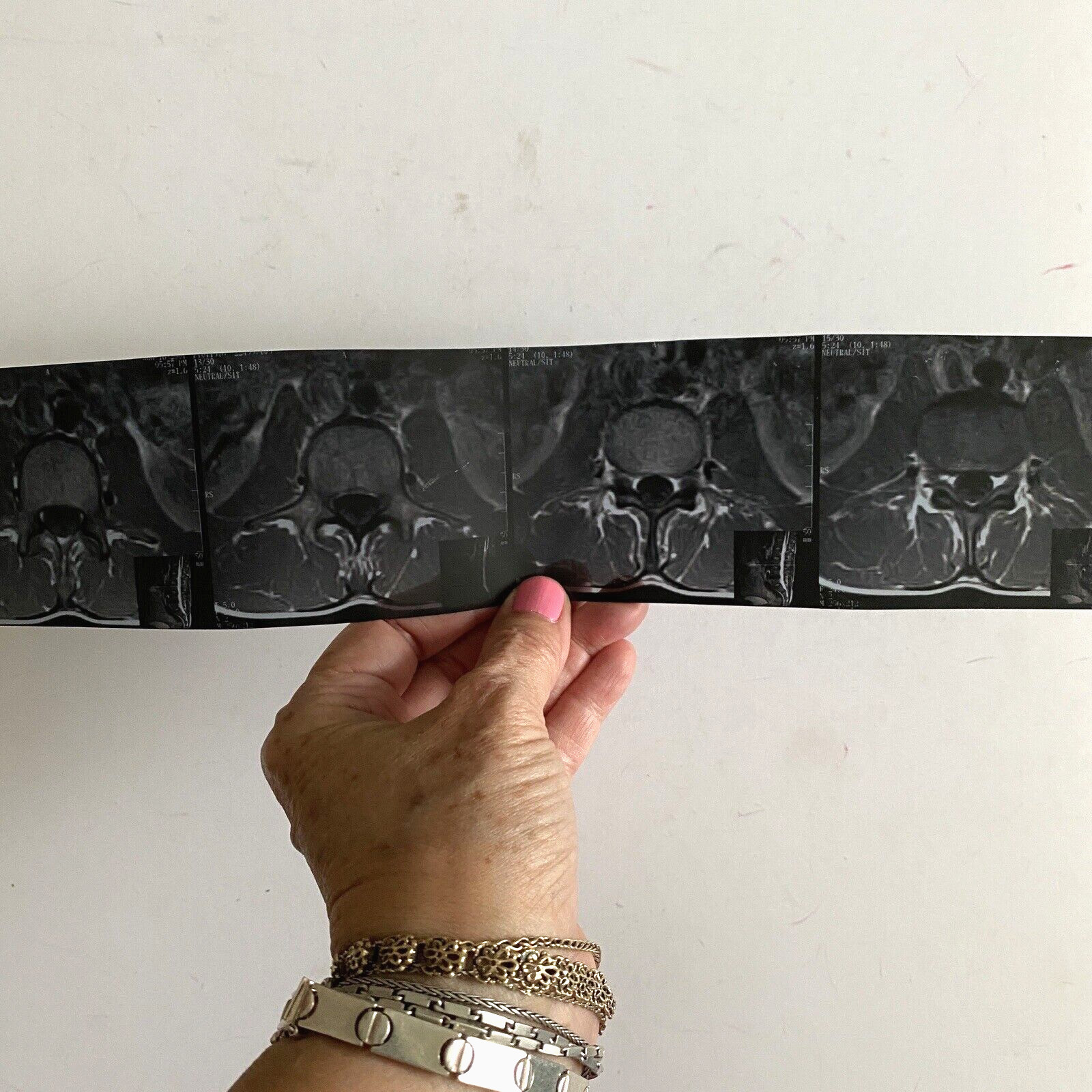 Real Spine X-Ray Slice 4-View Film Sheet Education Art 14x2.7in PII Removed