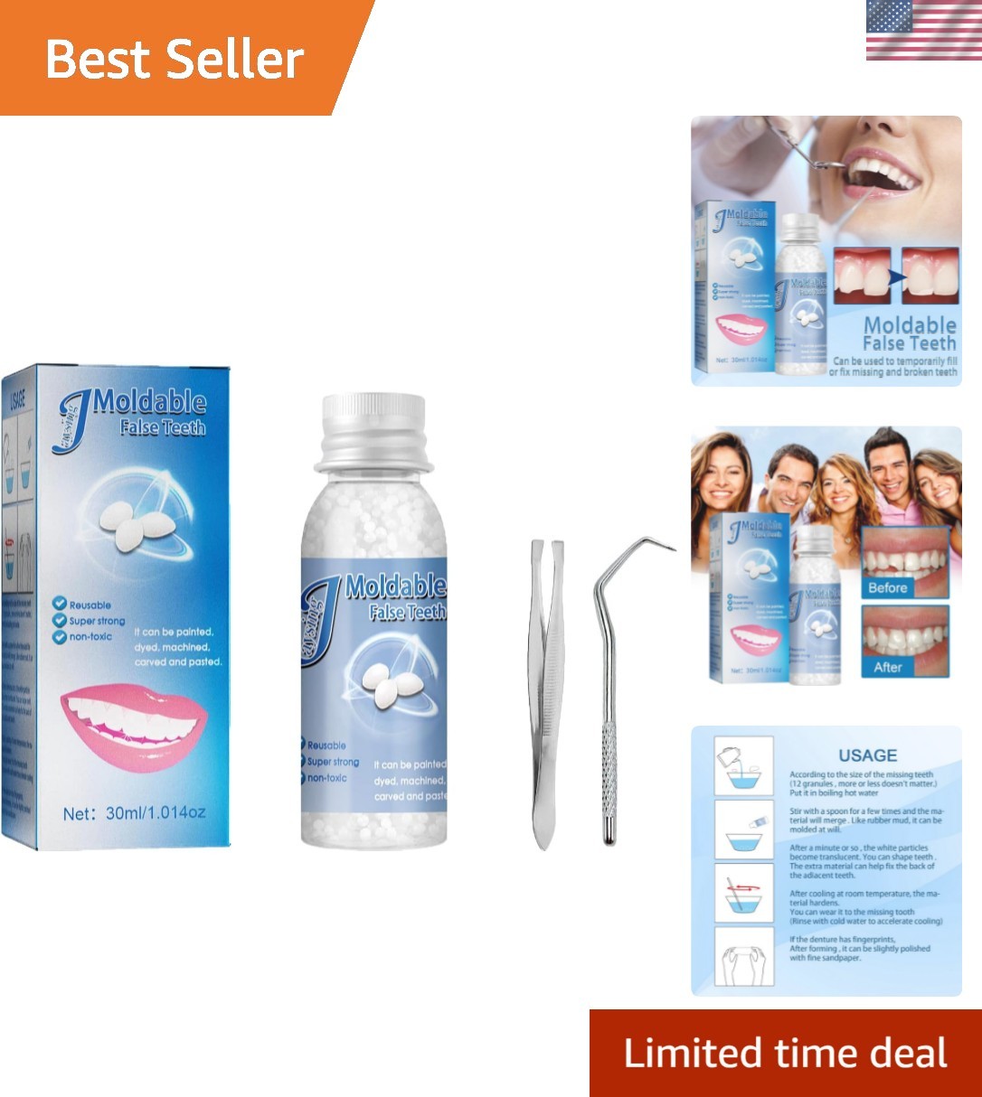 Dental Repair Denture Repair Beads,Tweezers,Dental Pick,Dental Tools for Fixi...