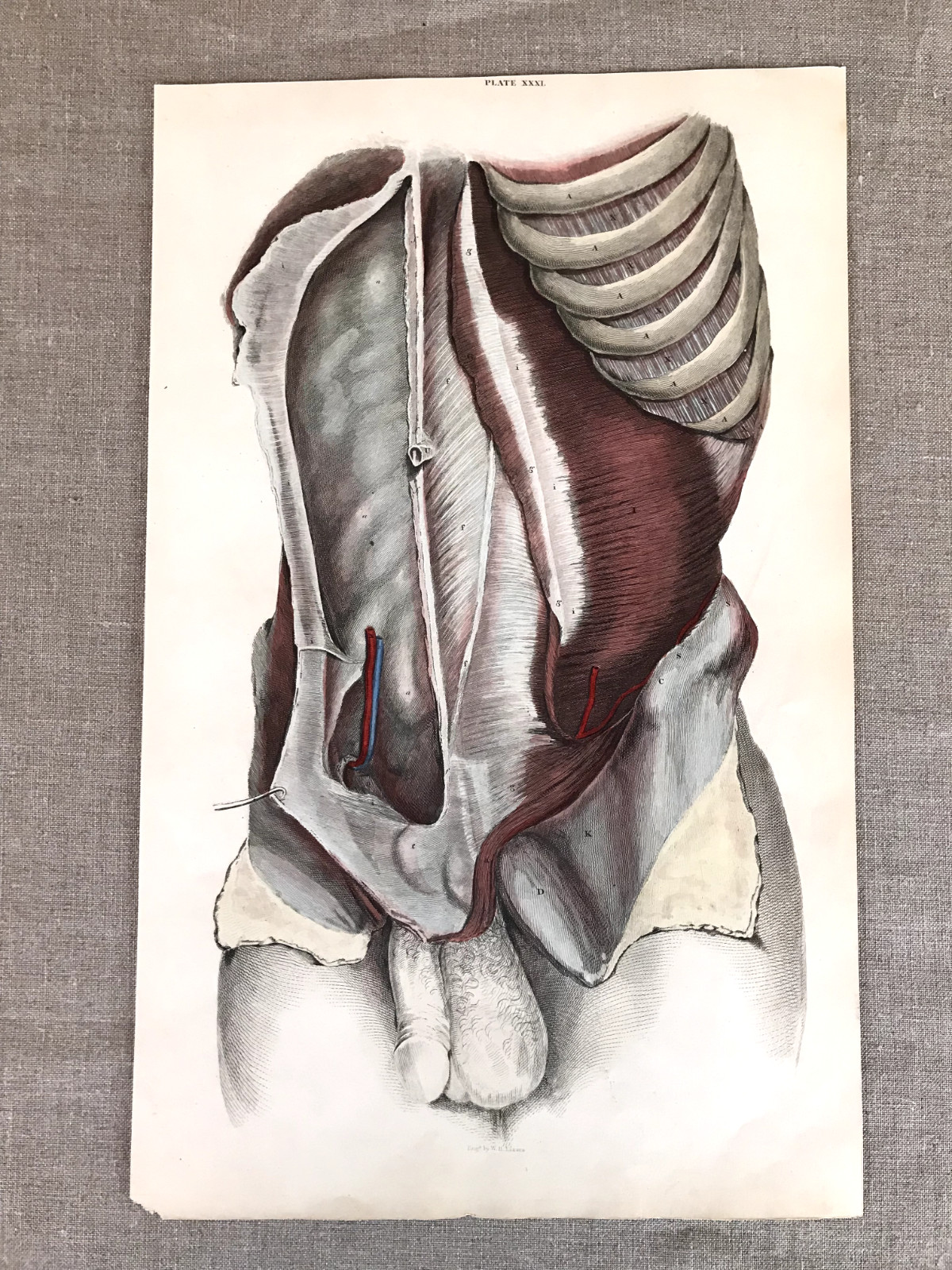 Antique 1824 John Lizars Anatomical Engraving, Plate 31, unframed.