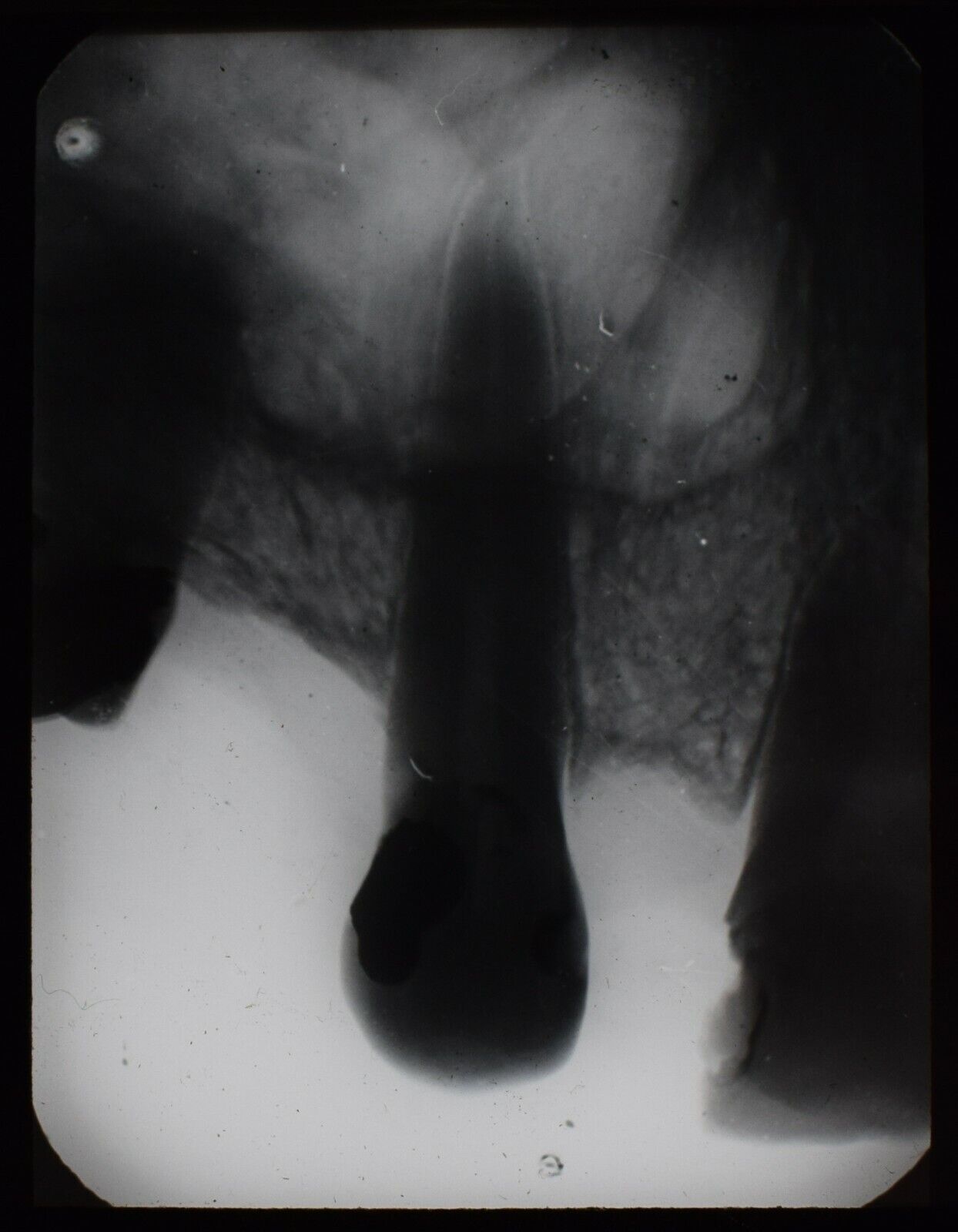 Magic Lantern Slide XRAY DENTAL ROOT PROJECTING C1947 VINTAGE MEDICAL PHOTO 