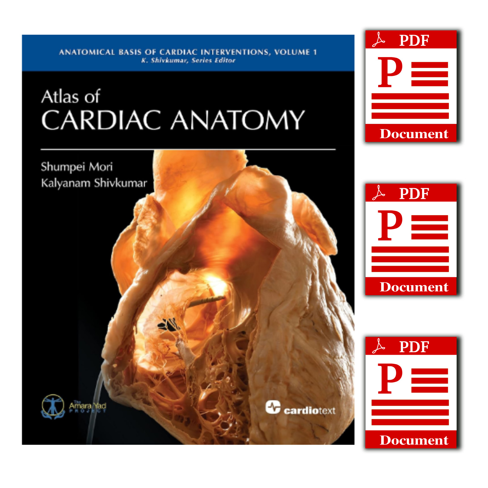 Atlas of Cardiac Anatomy: Anatomical Basis of Cardiac Interventions, Volume 1 1s