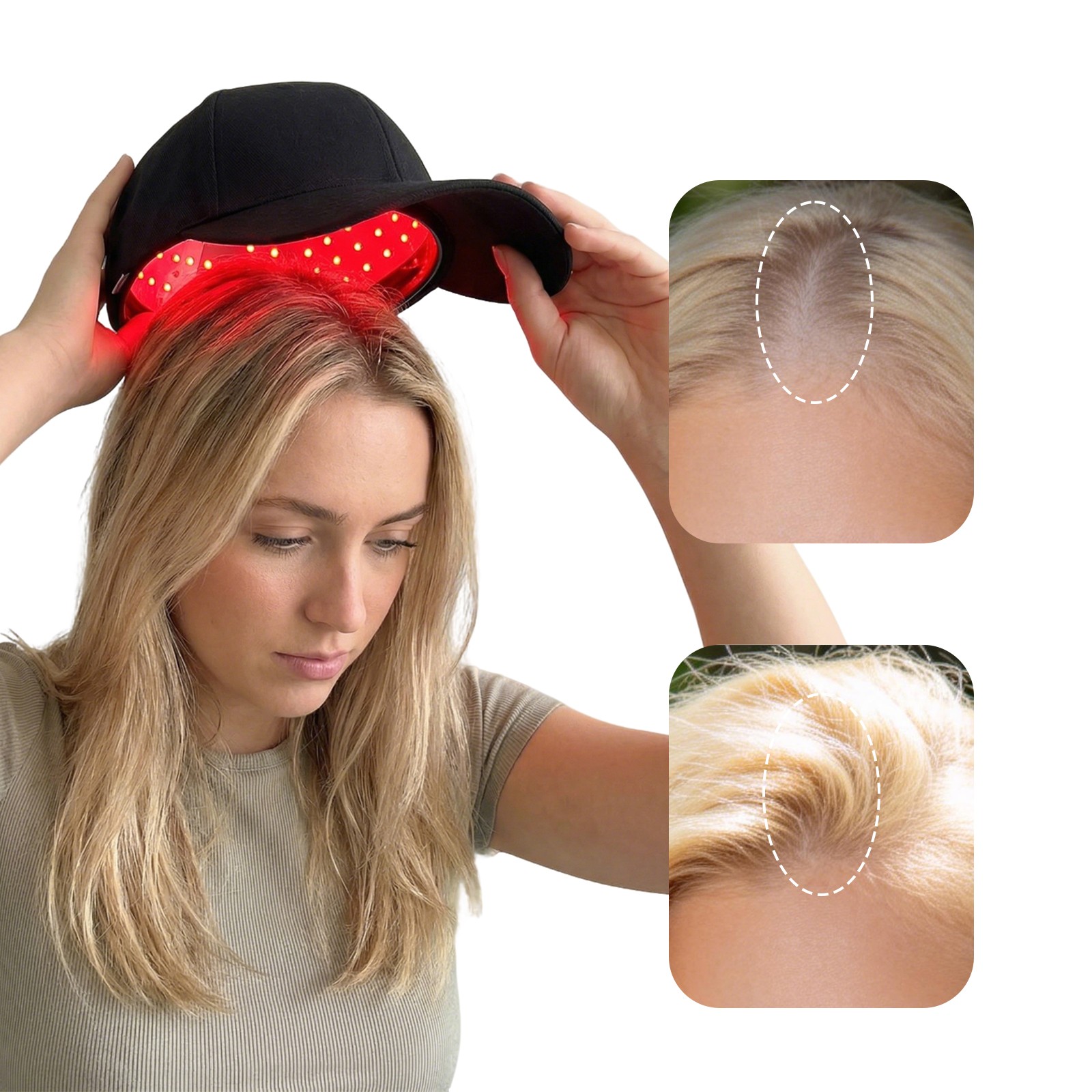 650nm Laser Red Light Therapy Hat Hair Loss Treatment Cap Hair Growth Regrowth