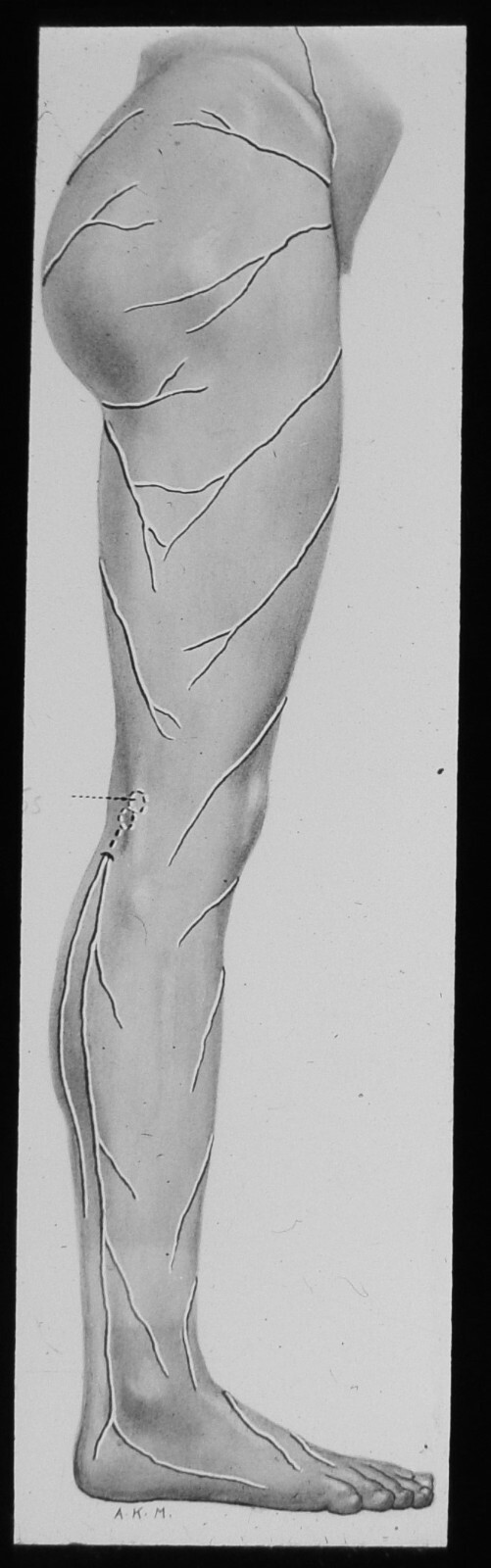 THE LEG SHOWING VEINS C1950 Magic Lantern Slide MEDICAL ANATOMY DIAGRAM VINTAGE