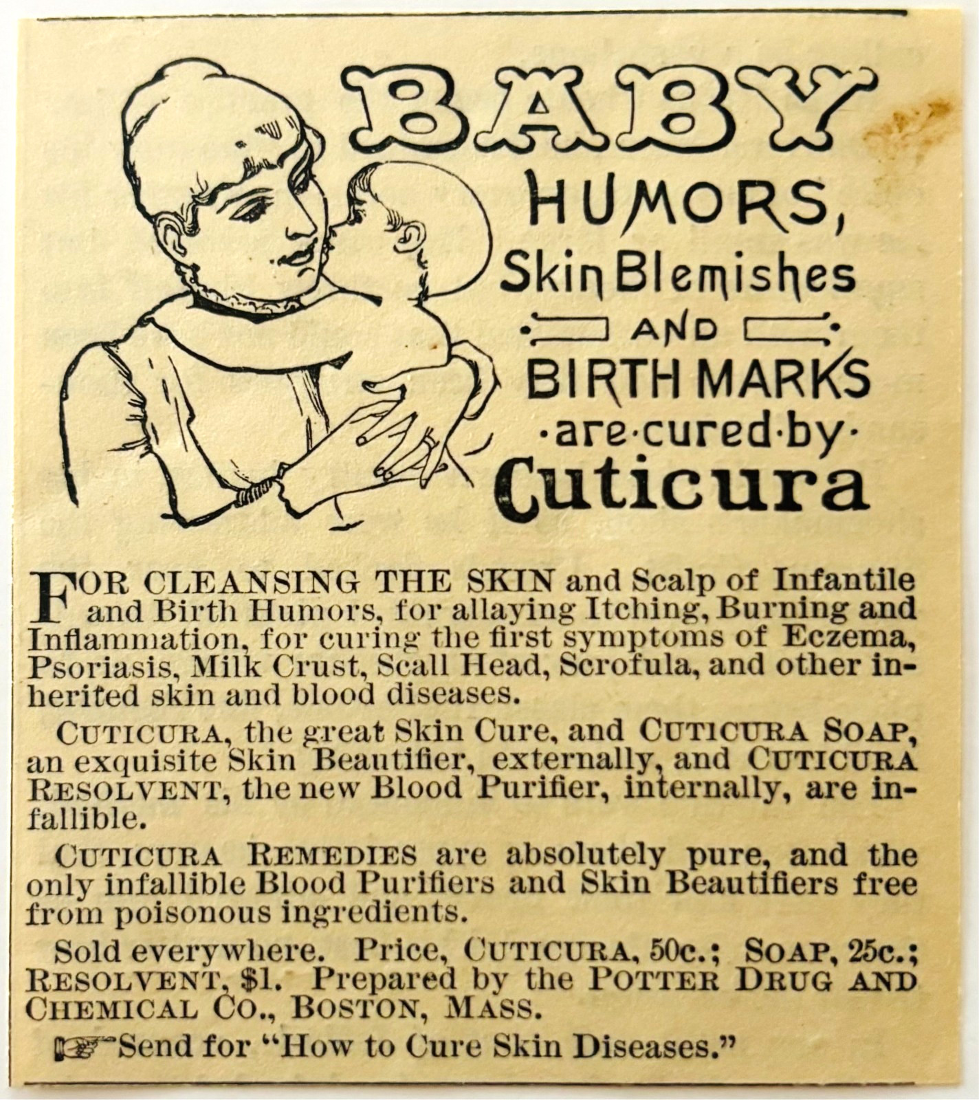 1886 Cuticura Medicinal Soap Advertisement Victorian Quack Medicine DWKK27H