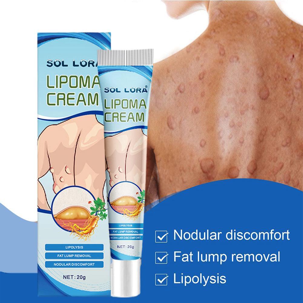 20g Lipoma Soothing Cream Instant Ointment Relieving Agglomera Discomfort  RYD
