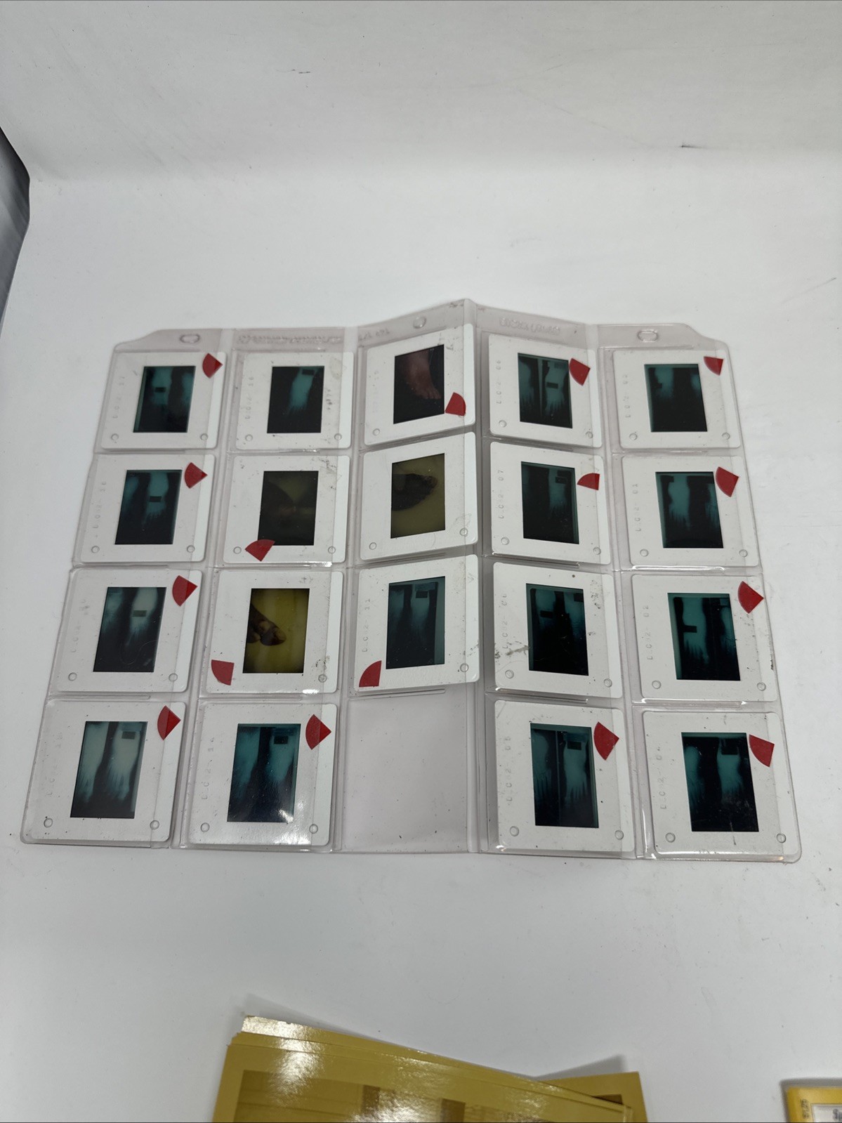 Real Foot X-Ray Bunyon Panels Film Education Art 2”x2” Images Medical