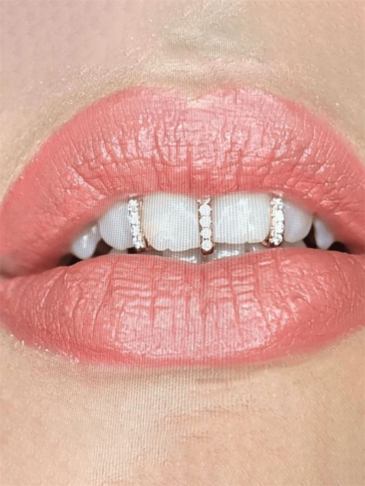 Metal Electroplating Teeth Braces Plated Teeth Upper Top or Lower Grill + Mold