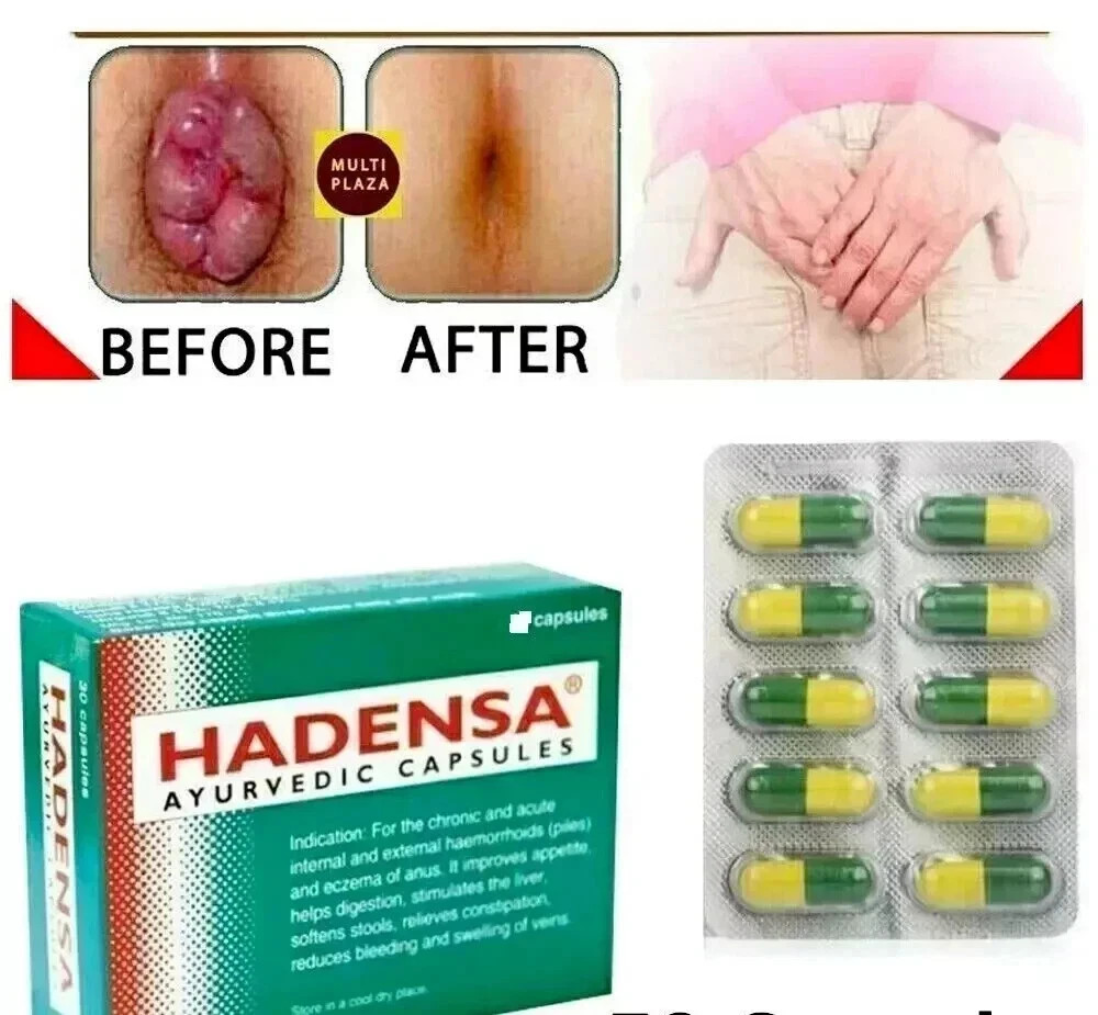 Hadensa Ayurvedic 50 Pills Hemorrhoids & Piles Pain Relief Itching Swelling 2027