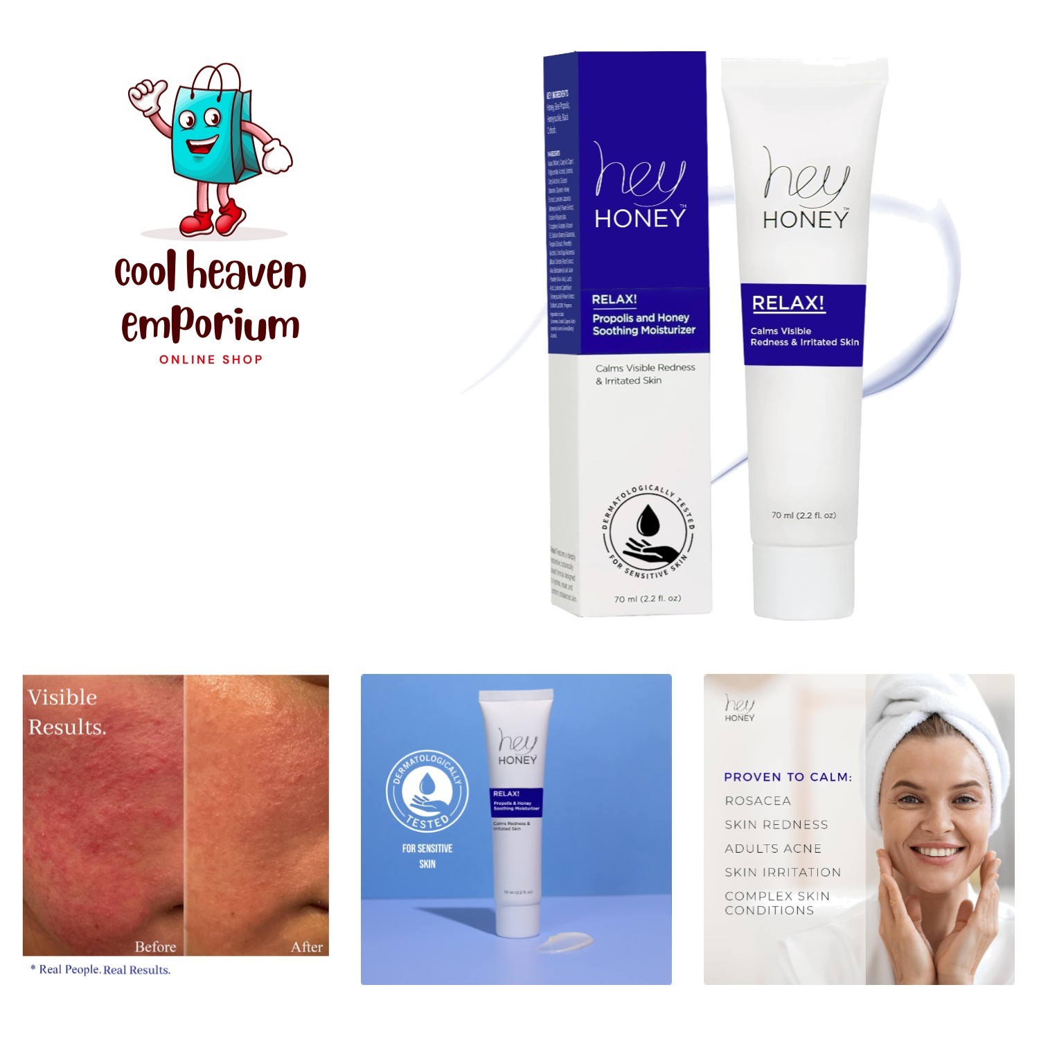 Instant Rosacea Relief Cream - Calming Moisturizer for Sensitive Skin, 2.2 Oz