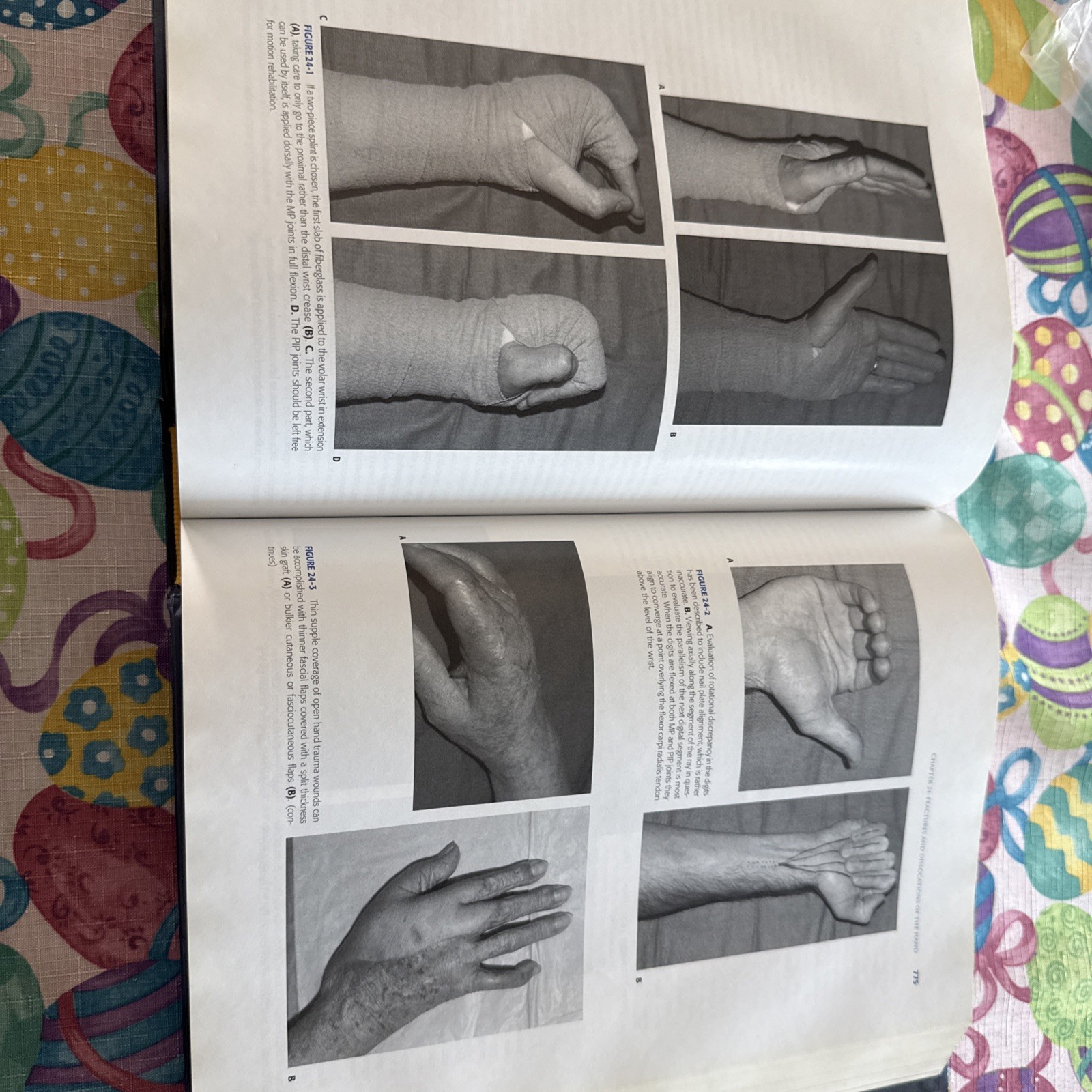 Fractures In adults Eighth Edition Volume 1 Only!!!