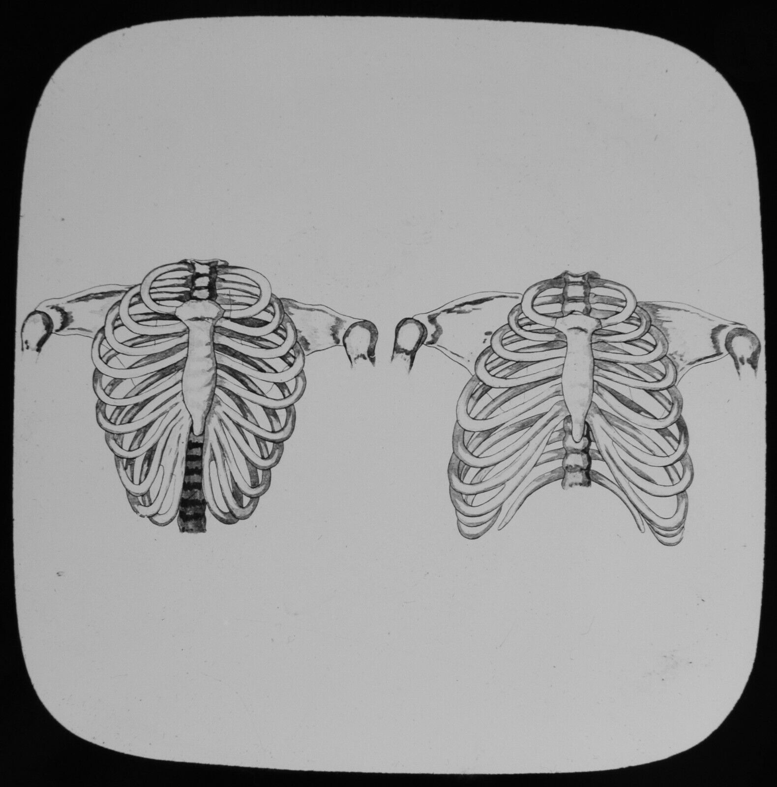 Magic Lantern Slide HUMAN PHYSIOLOGY NO11 LACING C1888 MEDICAL ILLUSTRATION