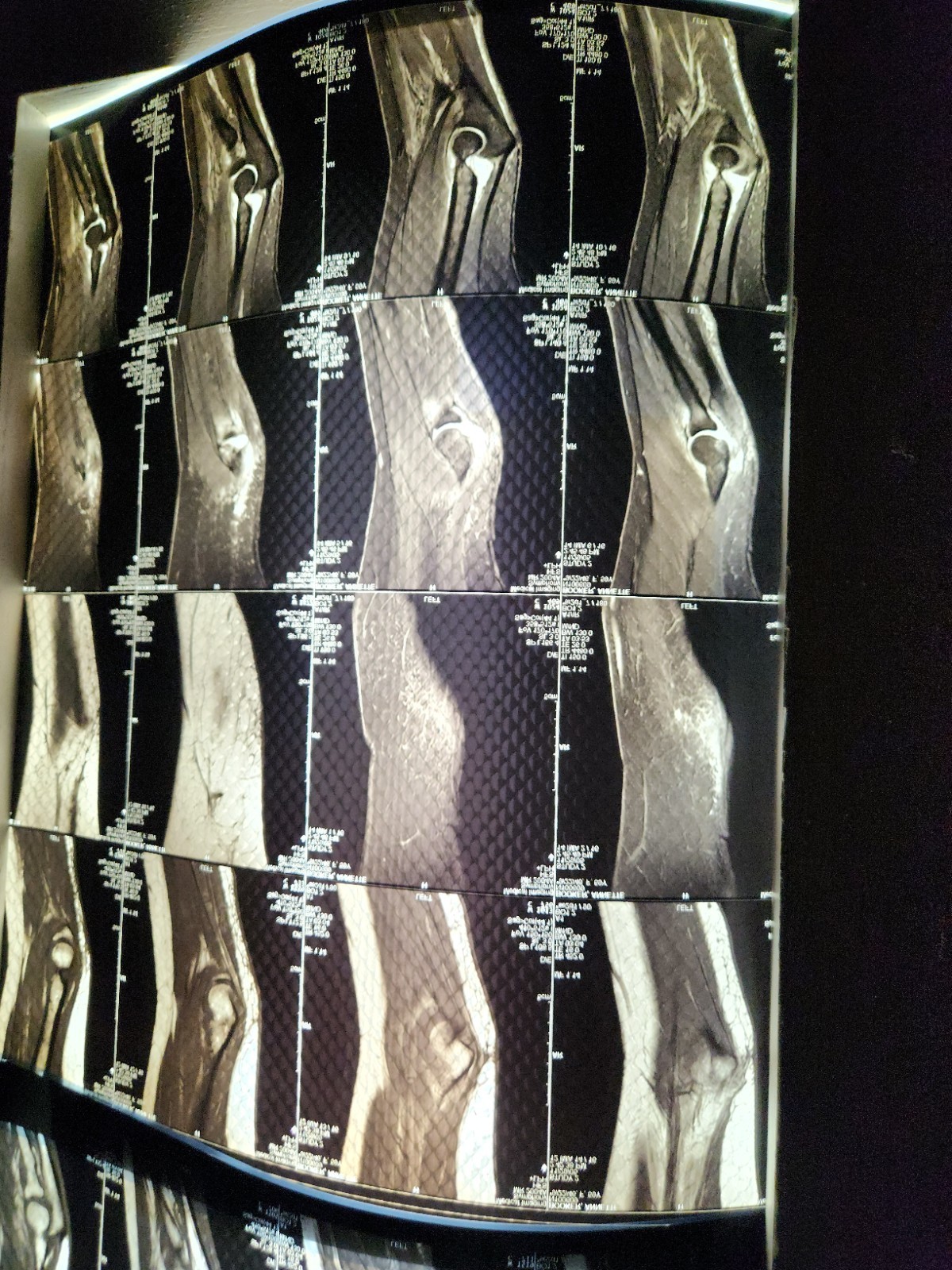 Vintage Medical X-rays Lot of 15+ Pelvis-Elbow-Spine MRI Scan Oddity 