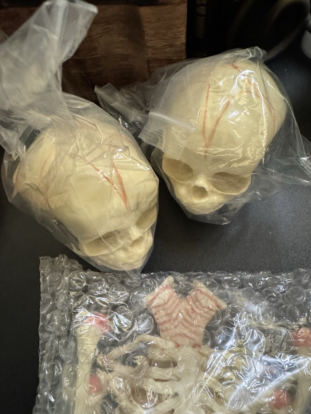 Medical Fetus Skeletons